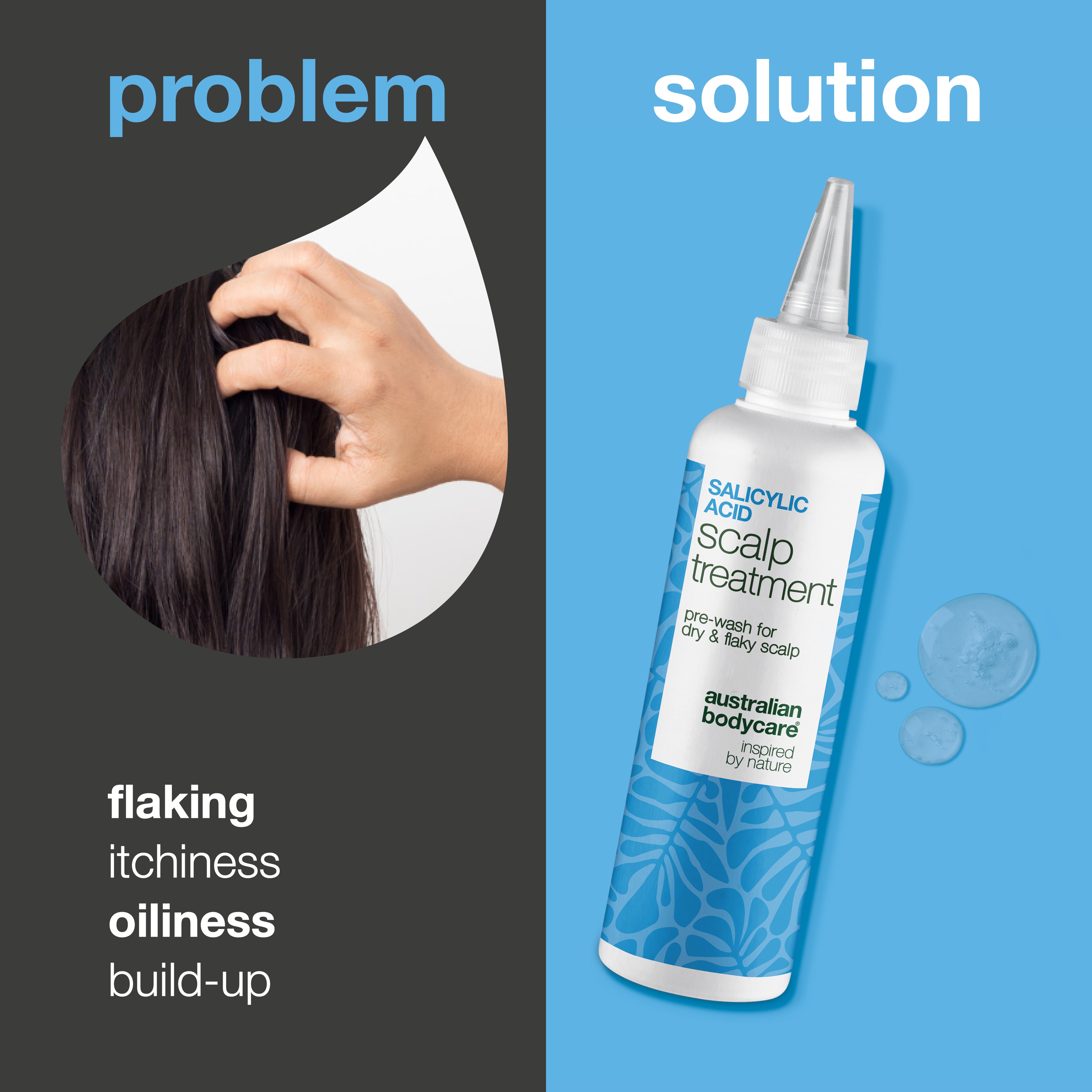 Salicylic Acid Scalp Treatment for oily & flaky scalp — Salicylic Acid Pre-Wash Treatment relieves itchiness, flakes, and oil. Use before washing for deep exfoliation with active Salicylic Acid.