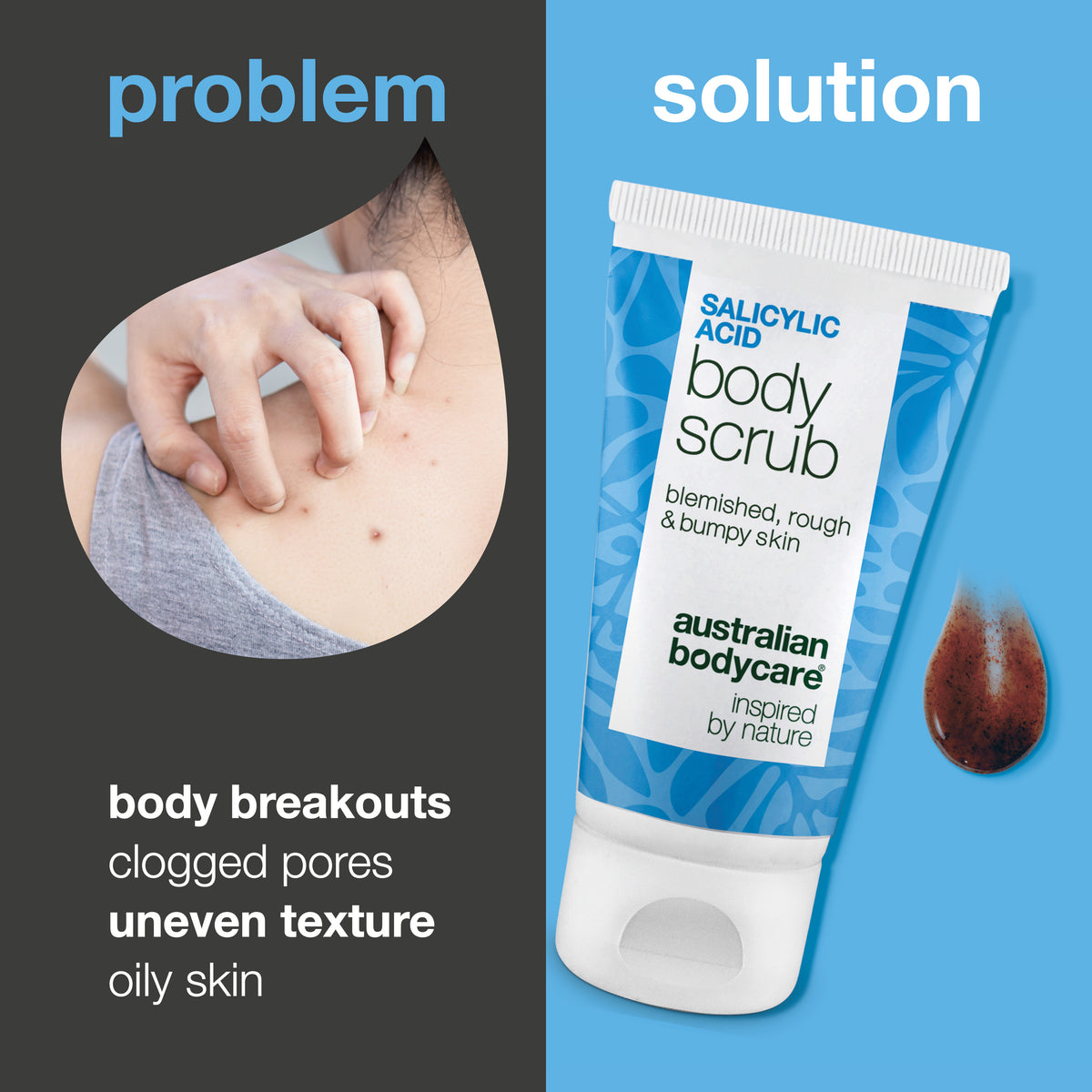 Problem and solution: body breakouts, clogged pores, uneven texture and oily skin. On the left a close-up of a shoulder with breakouts, on the right the Salicylic Acid Body Scrub from Australian Bodycare