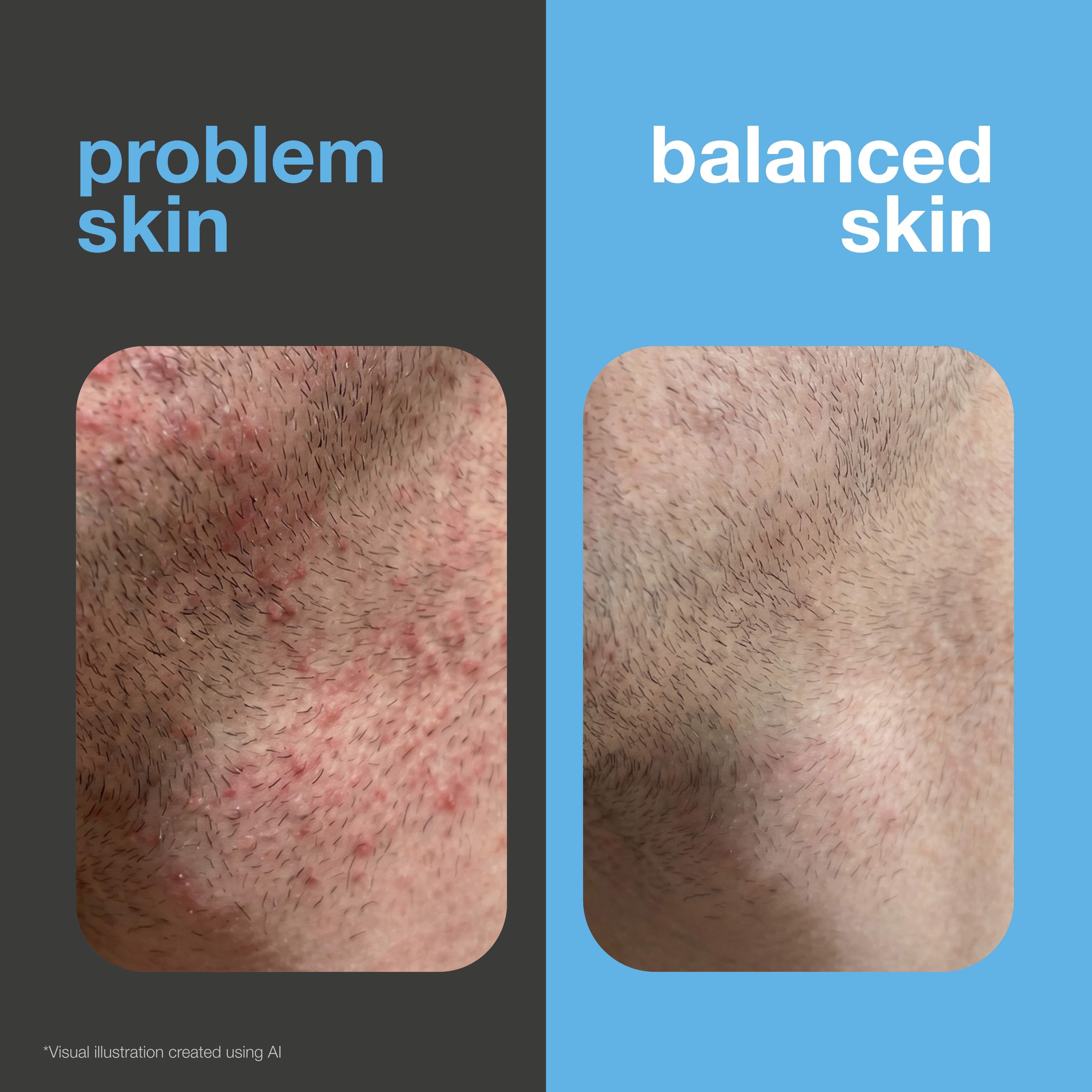 Before and after: shaved skin with razor bumps and irritation versus smooth, soothed skin. Visual illustration.