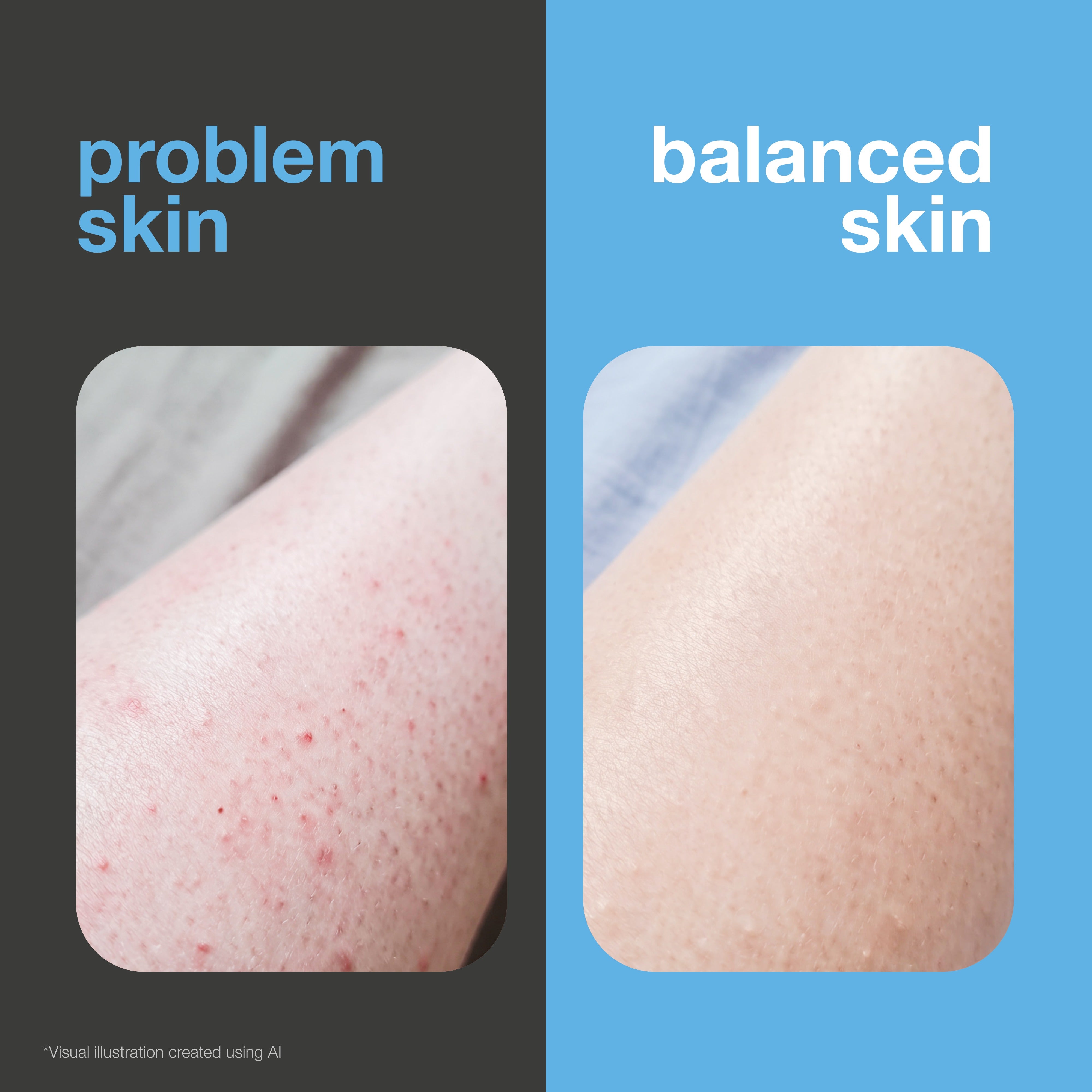 Before and after: shaved skin with razor bumps and irritation versus smooth, soothed skin. Visual illustration.