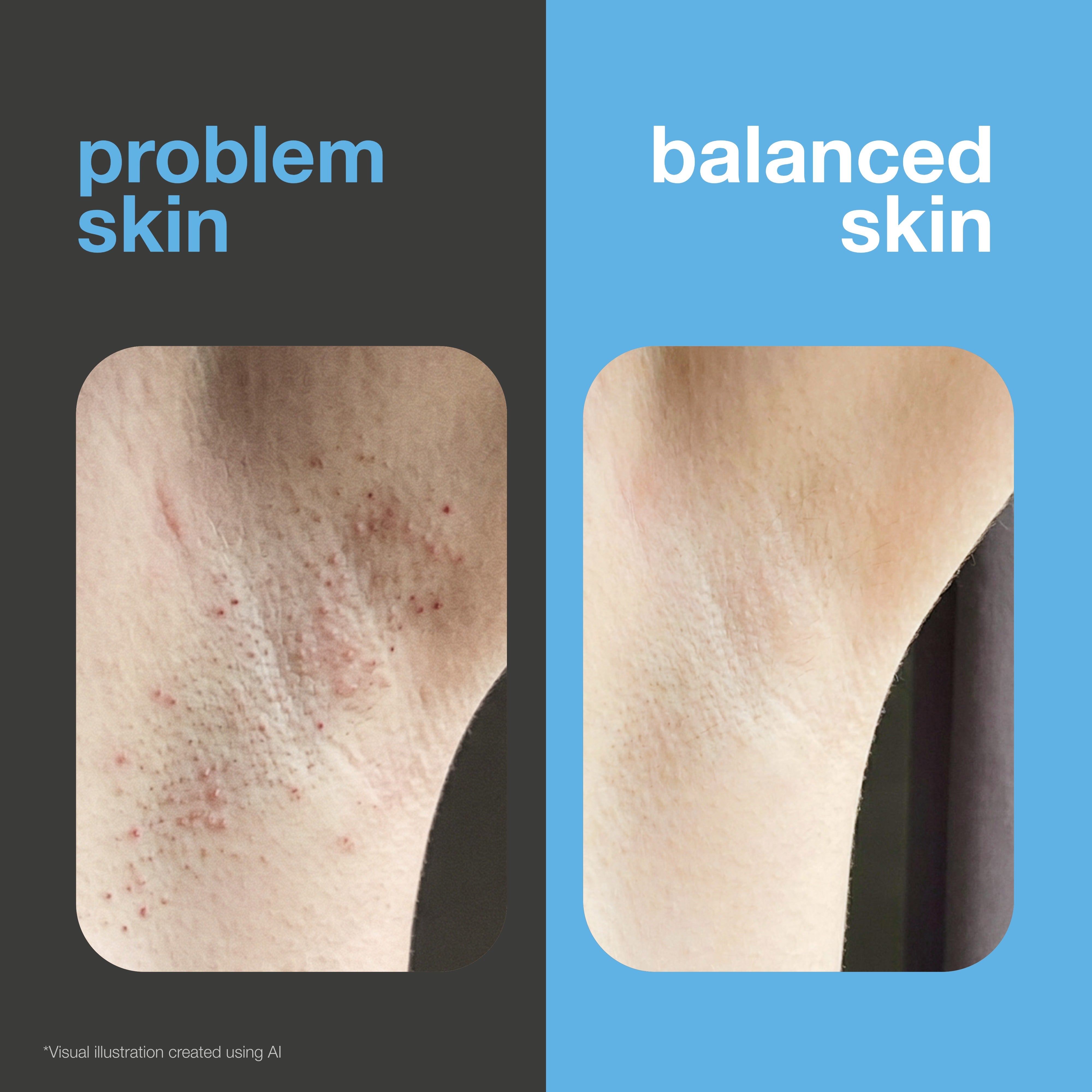 Before and after: underarm with ingrown hairs and dark marks versus smooth, even skin. Visual illustration.
