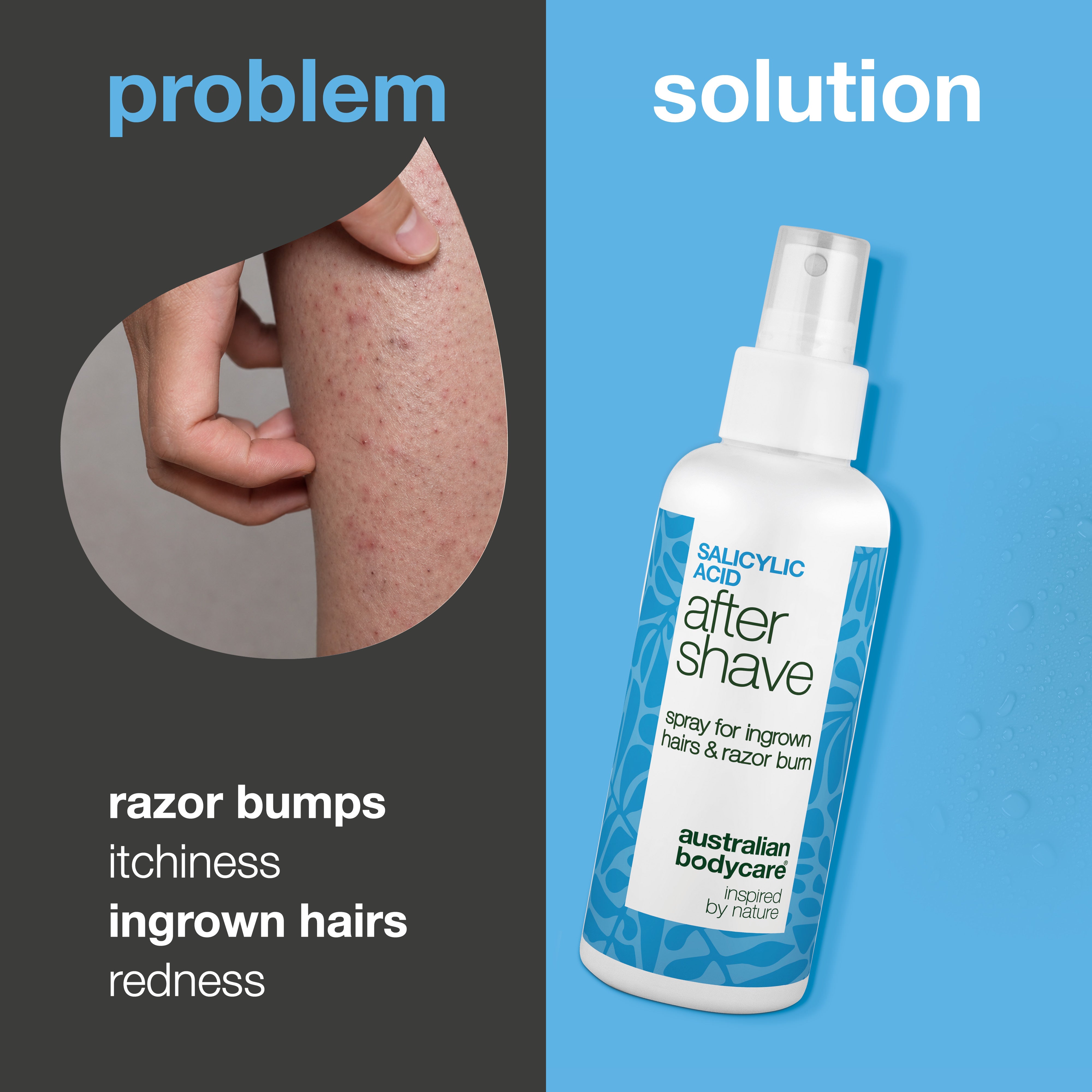 Products for razor bumps after shave - Australian Bodycare