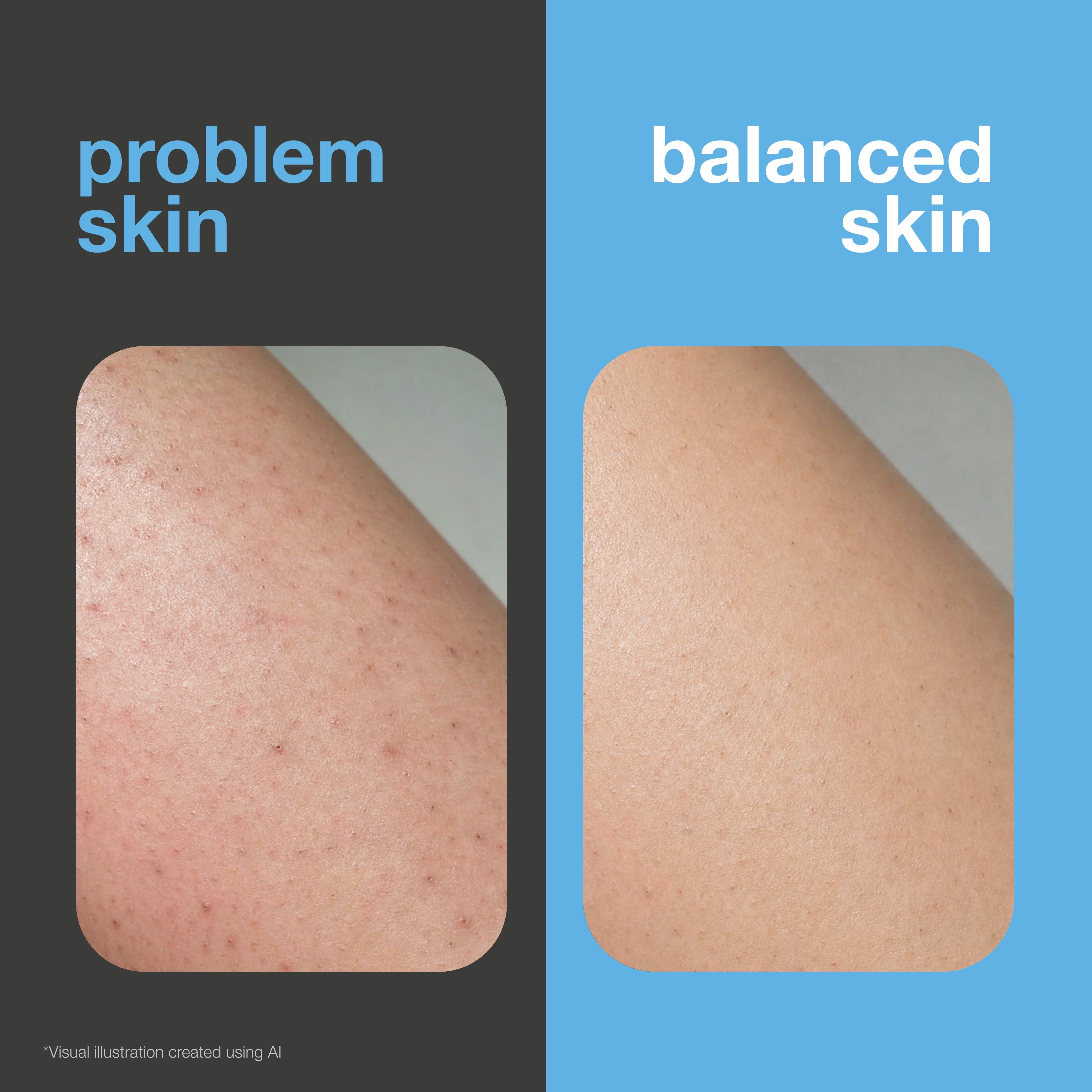 Before and after: shaved skin with razor bumps and irritation versus smooth, soothed skin. Visual illustration.
