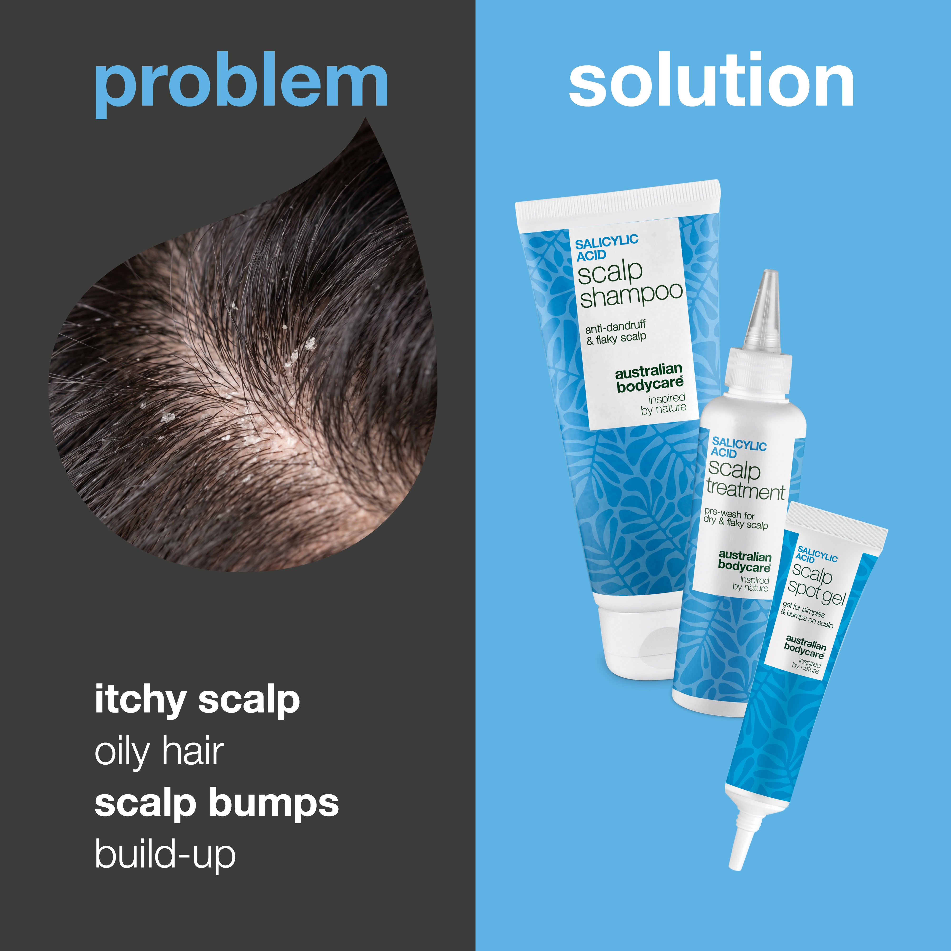 Problem and solution: close-up of itch, greasy hair and scalp buildup next to the three products in the set