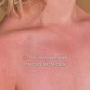 Woman applying salicylic acid body spray – before/after shows reduced acne and clearer skin.